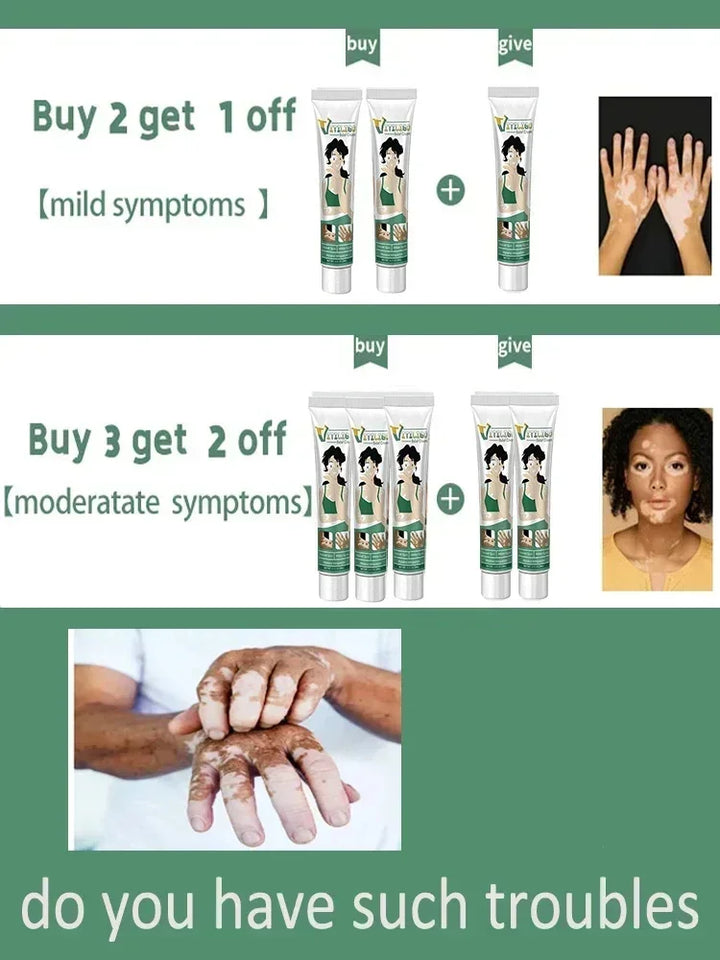 Herbal Extract Vitiligo Ointment Remove Ringworm White Spot Removal Skin care Vitiligo