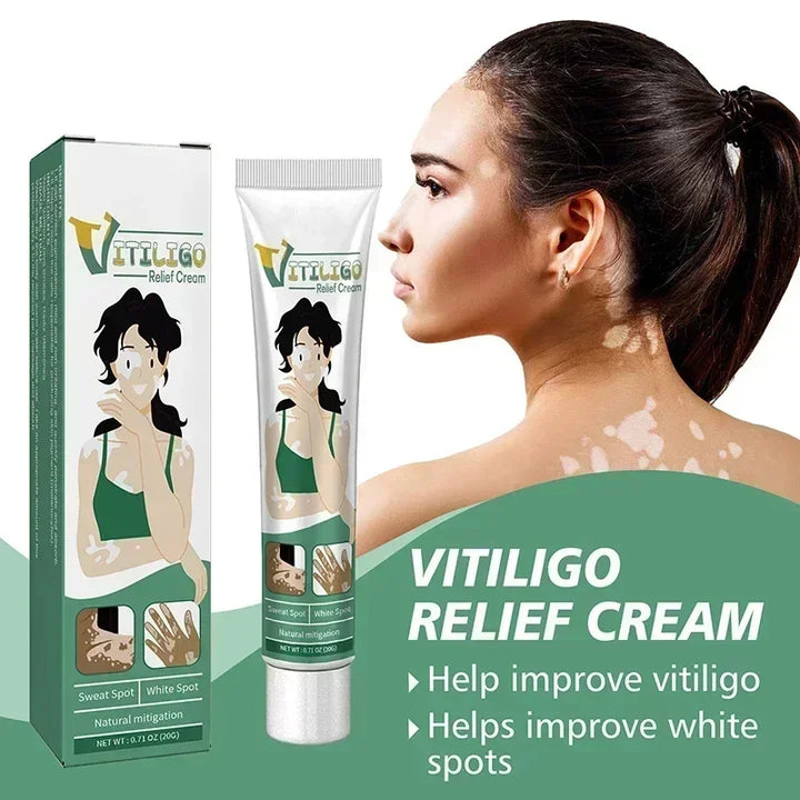 Herbal Extract Vitiligo Ointment Remove Ringworm White Spot Removal Skin care Vitiligo