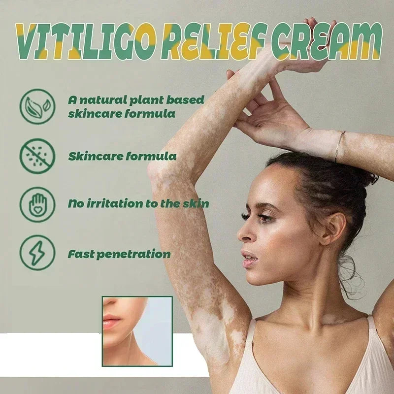 Herbal Extract Vitiligo Ointment Remove Ringworm White Spot Removal Skin care Vitiligo